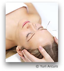 Illustration Akupunktur